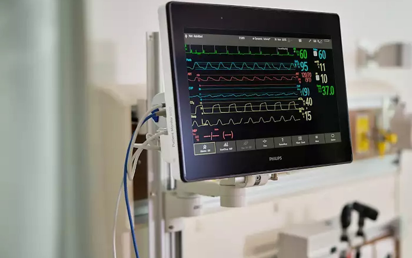 Bedside and ICU patient monitoring systems
